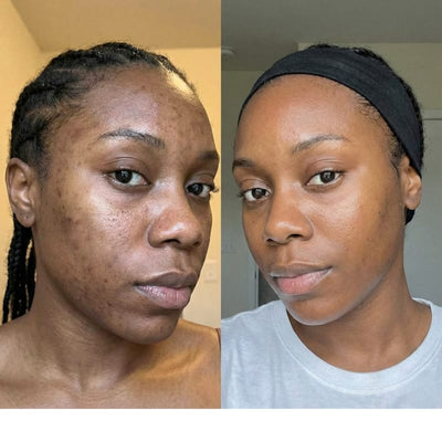 Customer photo